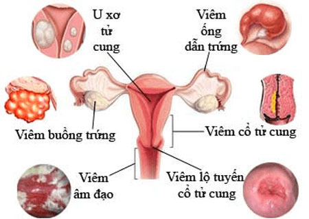 Phụ khoa